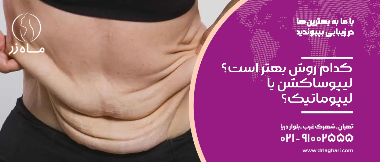 کدام روش بهتر است؟ لیپوساکشن یا لیپوماتیک؟