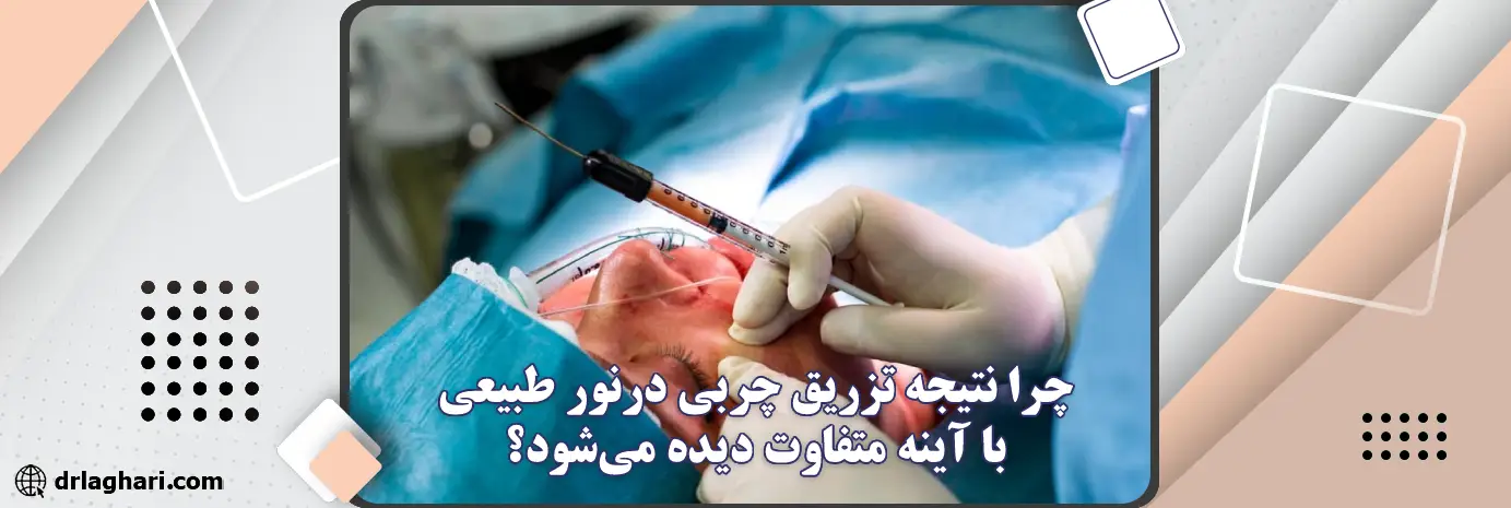 ظاهر واقعی تزریق چربی صورت