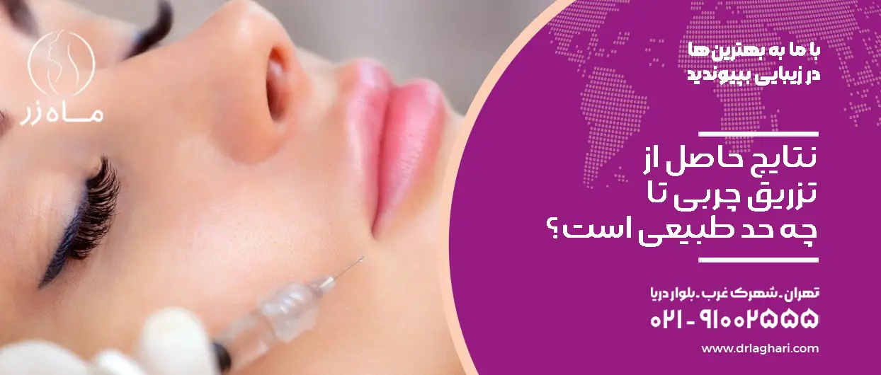 نتایج حاصل از تزریق چربی تا چه حد طبیعی است؟