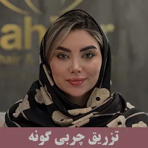 تزریق چربی گونه
