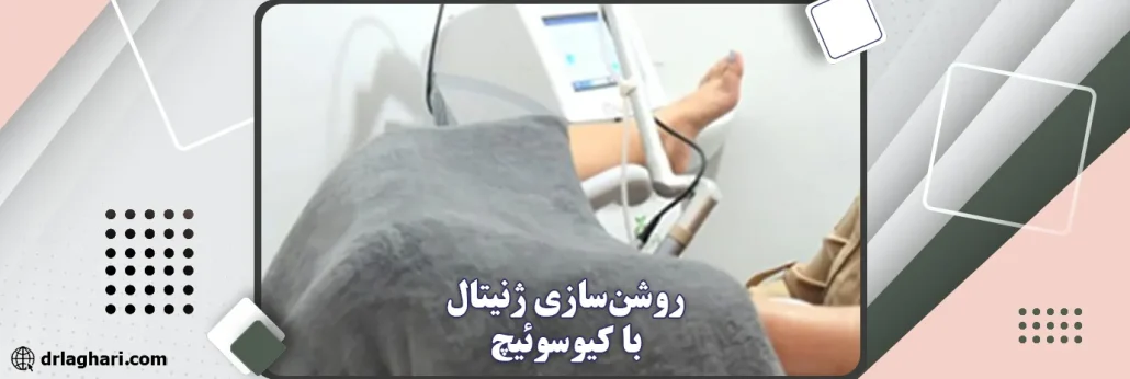 روشن‌سازی ژنیتال با کیوسوئیچ